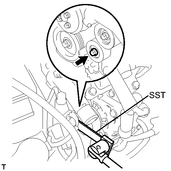 GTY146485
